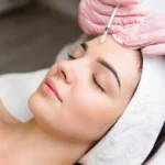 Dysport Treatment by Aesthetic Center of Excellence in Oklahoma City, OK