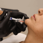 Dermal Filler Chin in Oklahoma City, OK