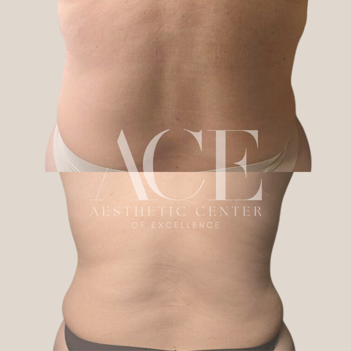 oklahoma city lymphatic drainage massage