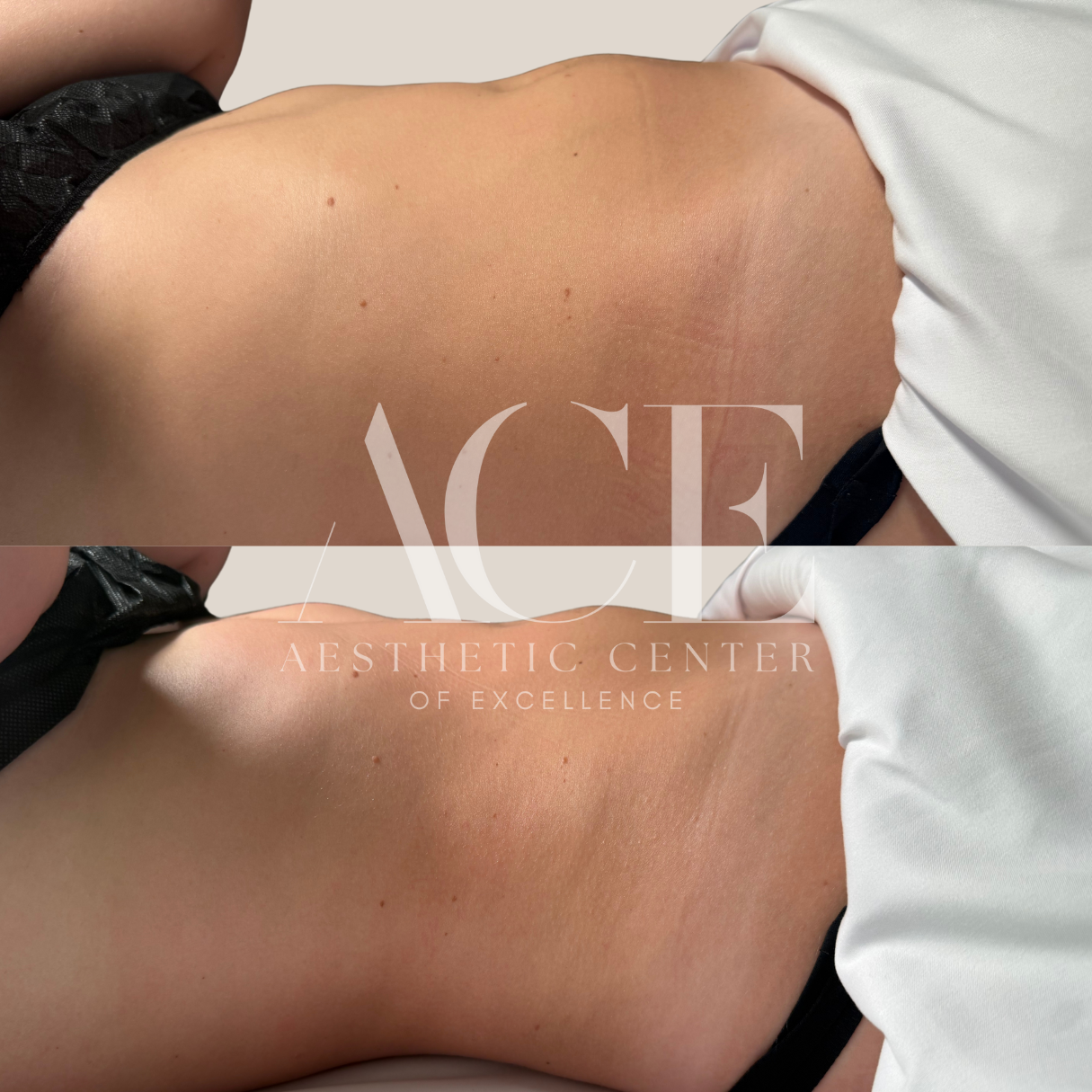 lymphatic massage drainage oklahoma city