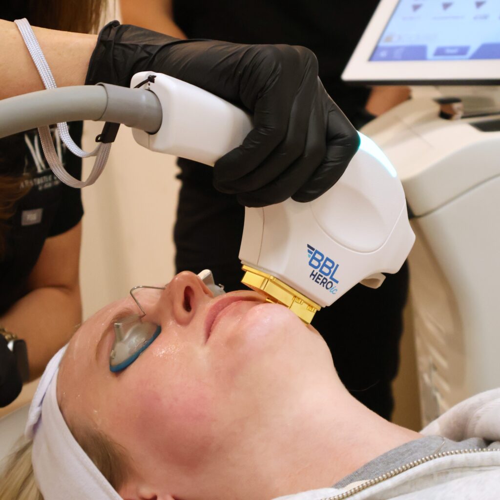Sciton BBL in Oklahoma: Transform Your Skin with Our 4 Luminaries (Your Guide) Sciton BBL in Oklahoma: Transform Your Skin | Aesthetic Center of Excellence in Oklahoma City, OK